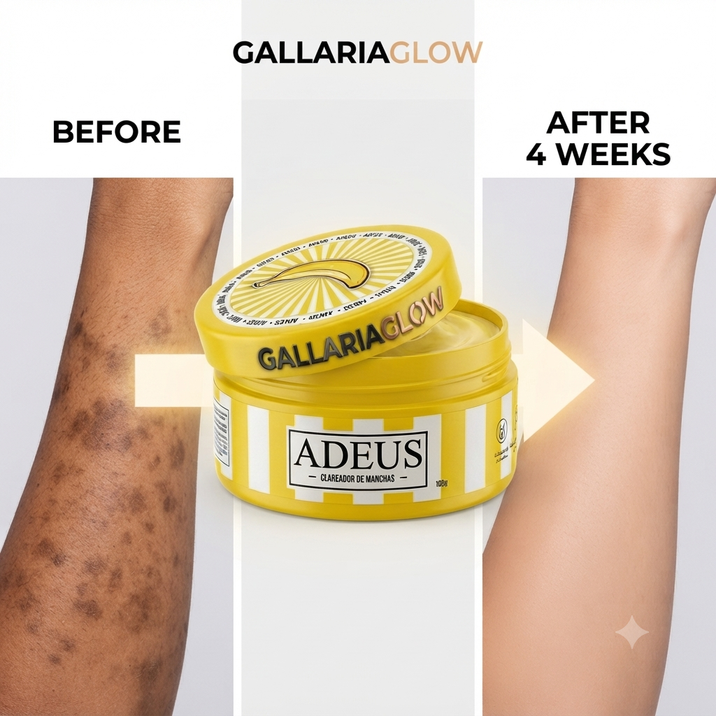 ADEUS Cream Dry Body,Multifunction and Stretch Marks